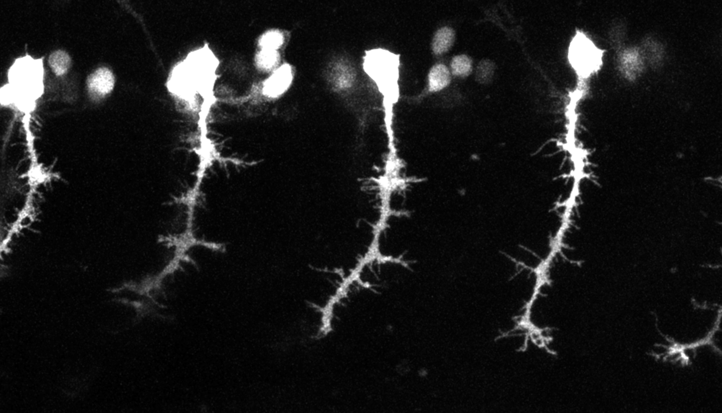 Zebrafish axons.