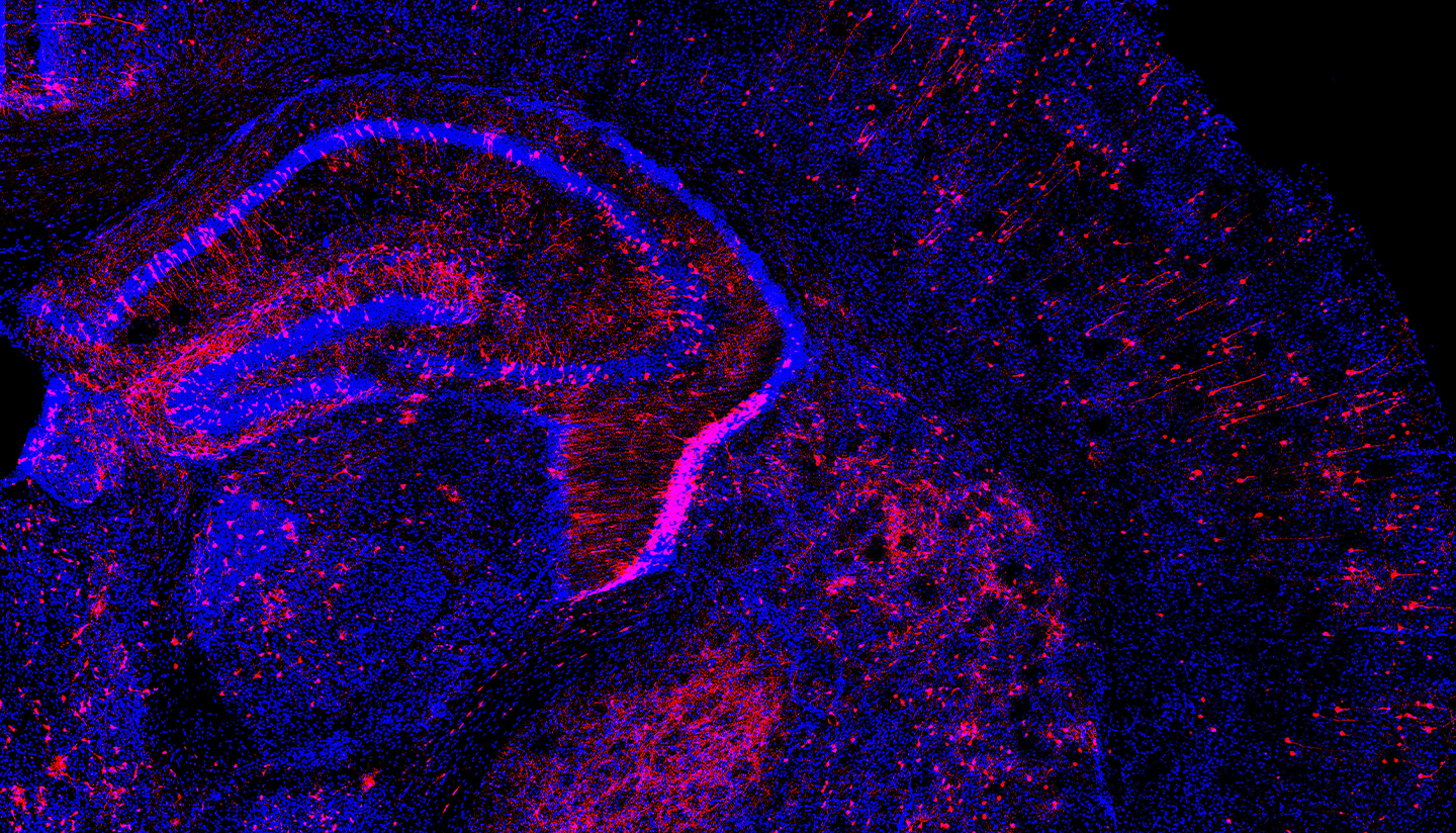 Microscopy image of the brain.