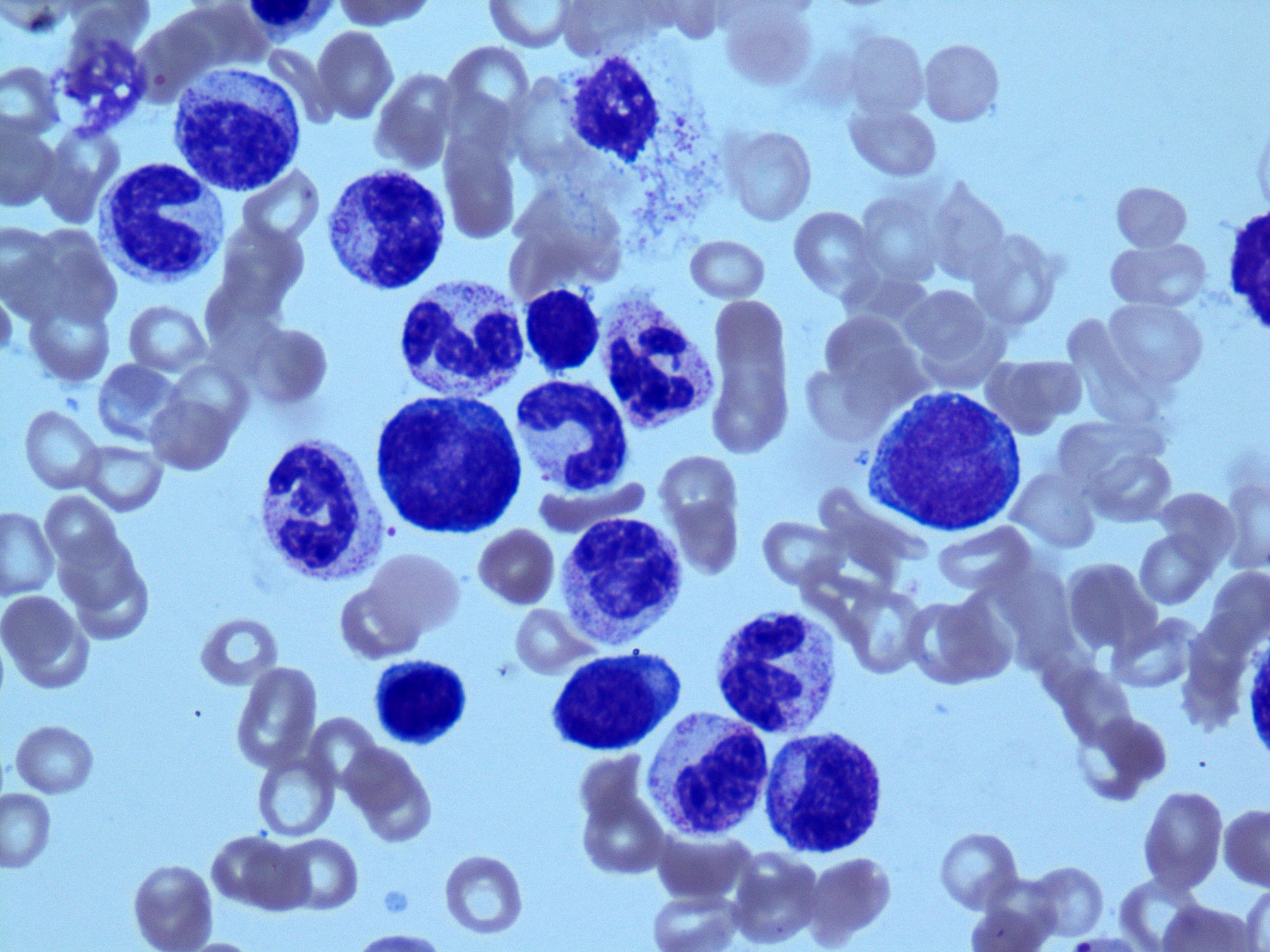 Bone Marrow