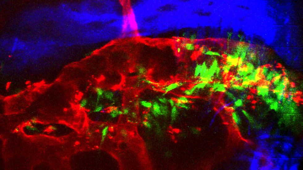 Calvarial suture vasculature cells