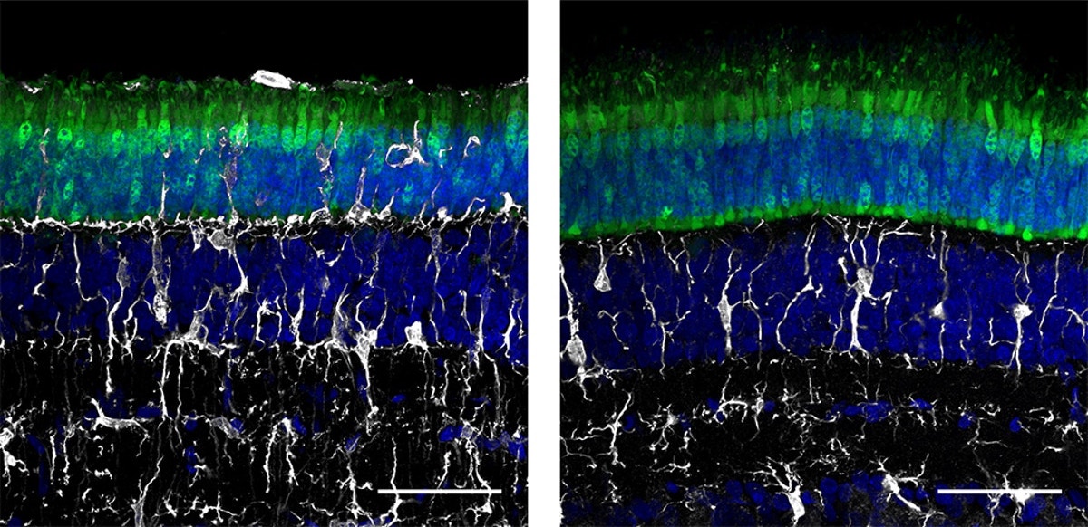 Two microscopy images of retinas.