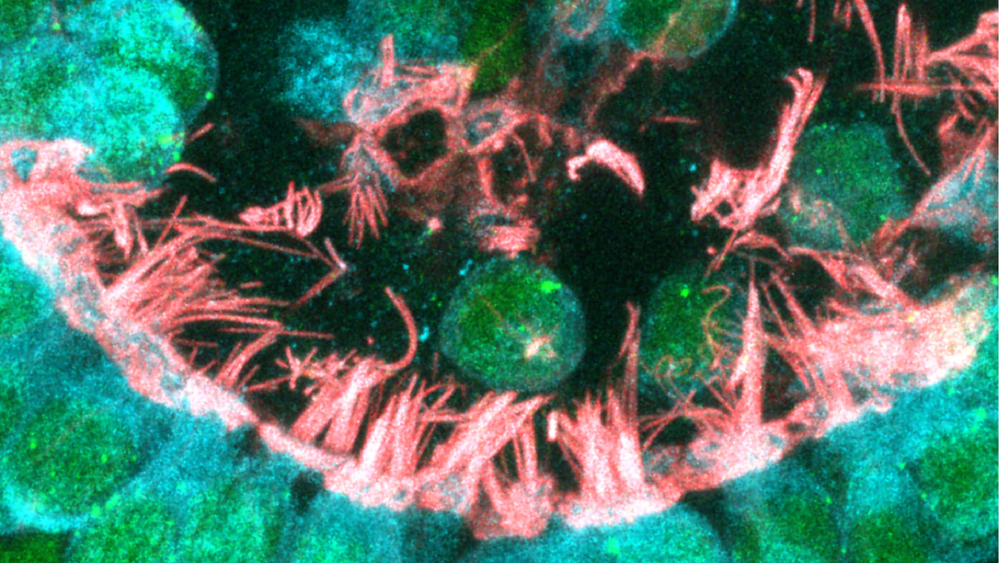 Microscopy image of hair cells.