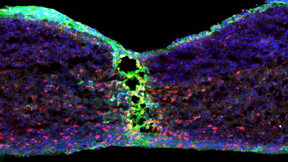 Microscopy image of spinal cord injury.