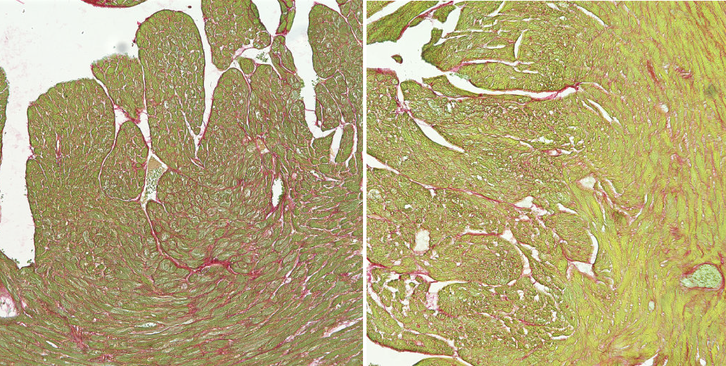 Microscopy image of heart tissue.