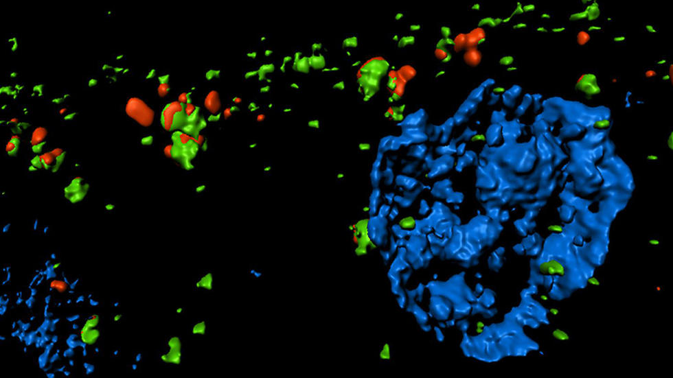 Kidney TASC image