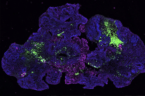 Microscopy image of a brain organoid