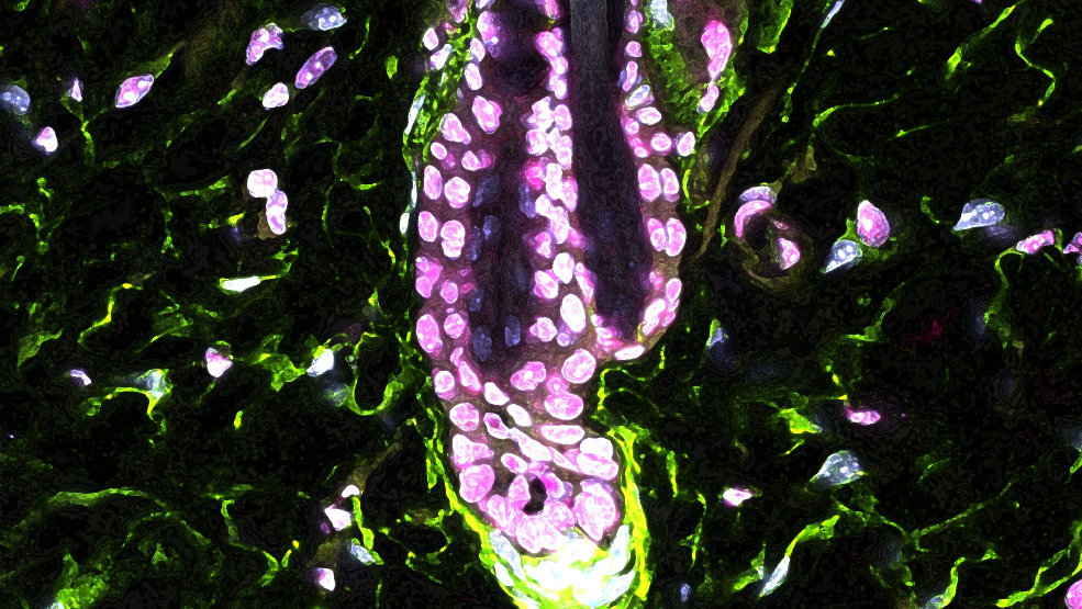 Microscopy image of a mouse hair follicle.