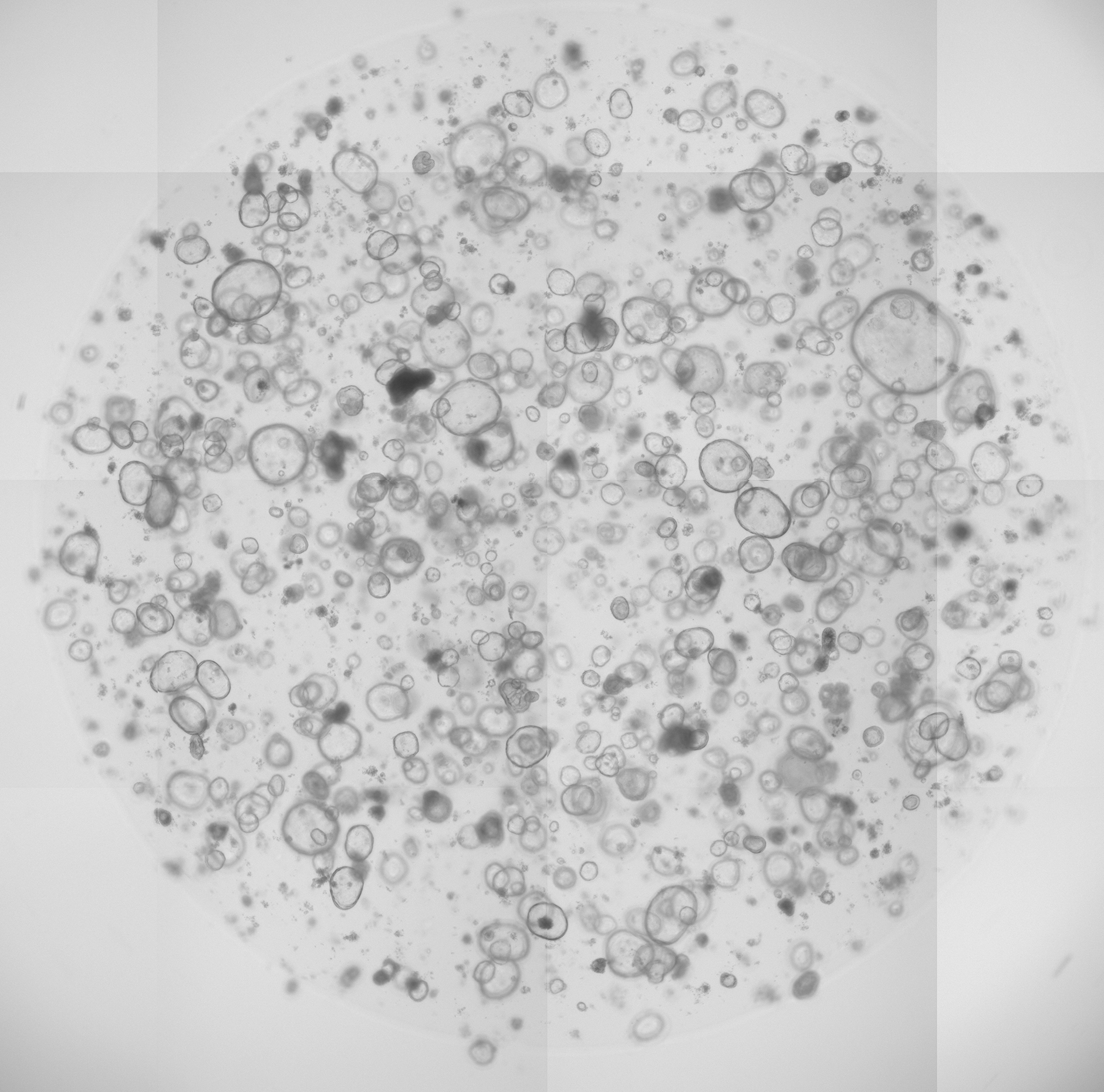 Human enteroids
