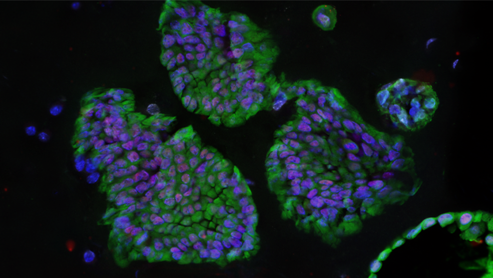 Lung organoids.