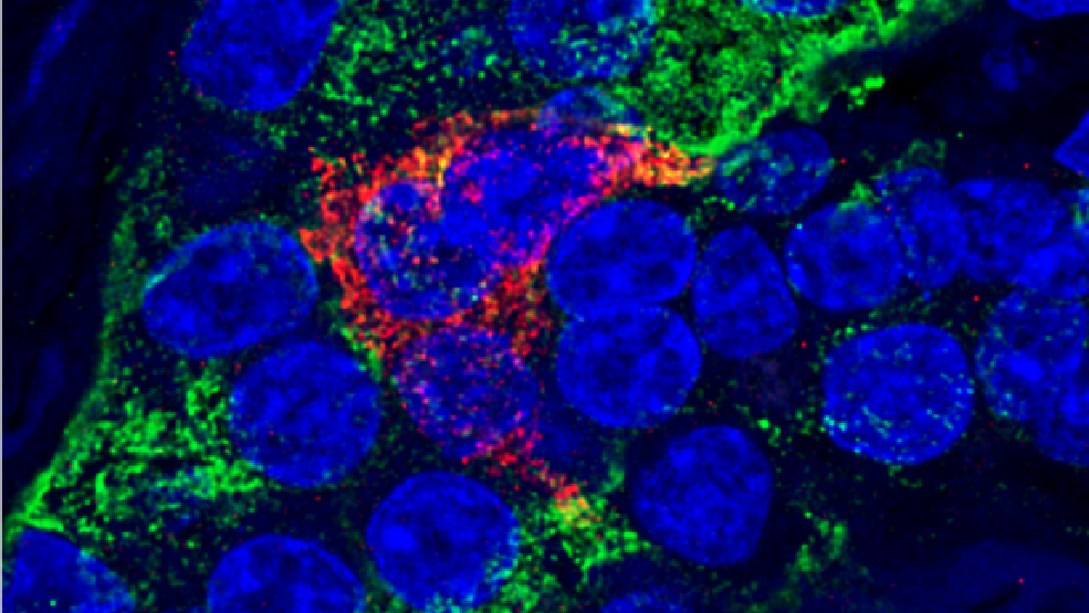 Microscopy image of the pancreas.