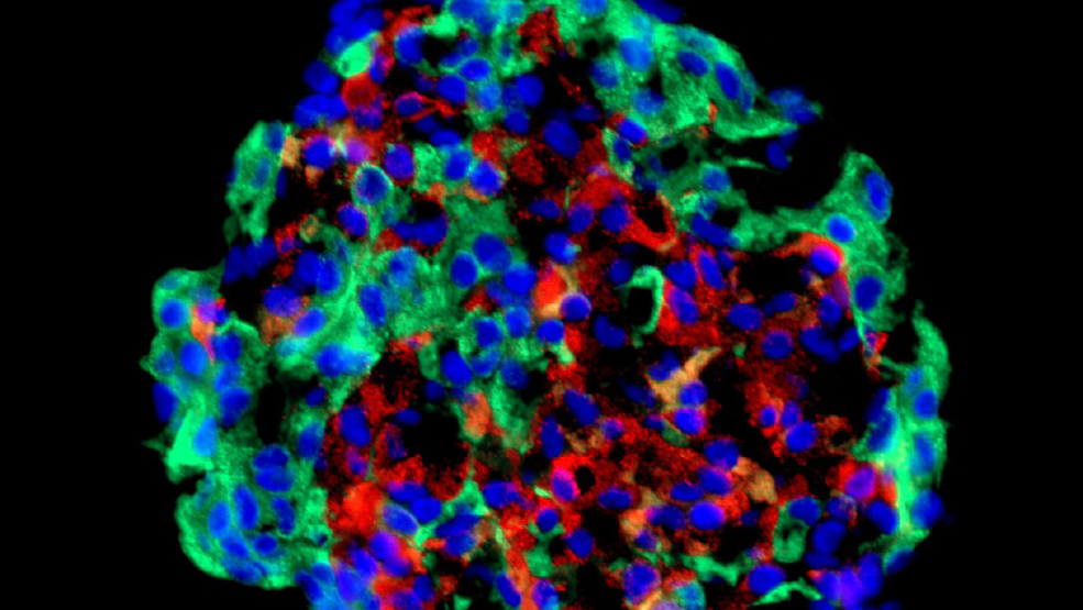 Cluster of cells under the microscope.