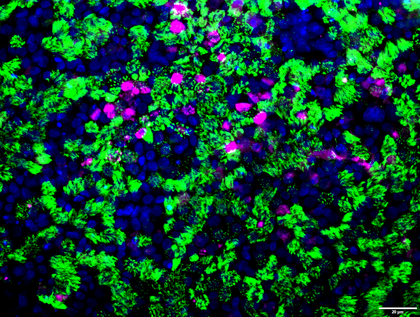 mucociliary_differentiation.jpg