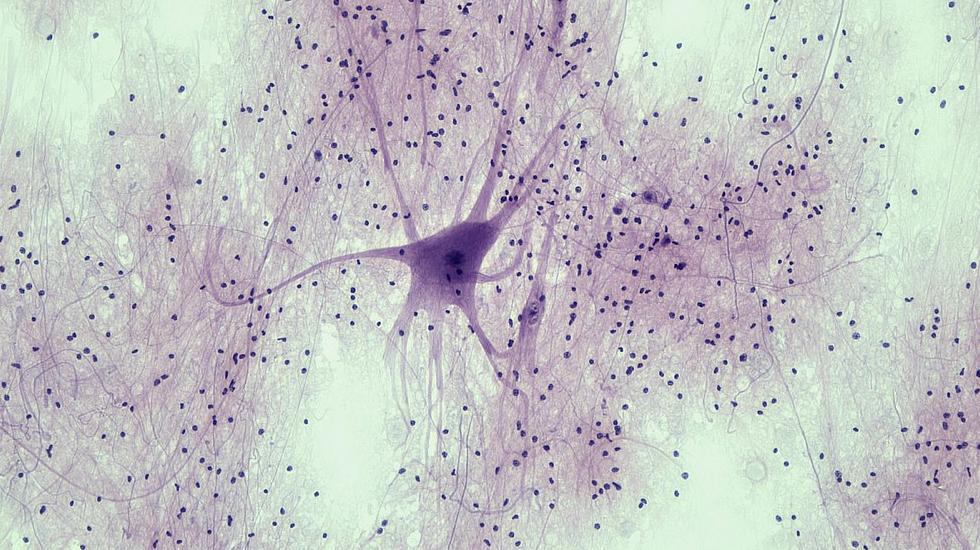 motor neuron