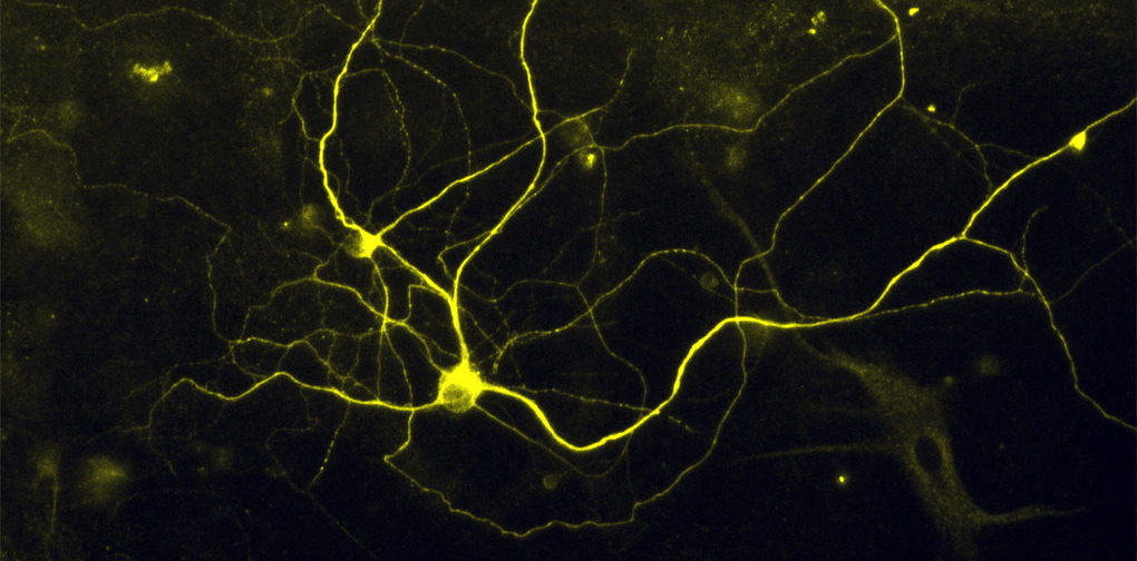 nociceptorweb.jpg