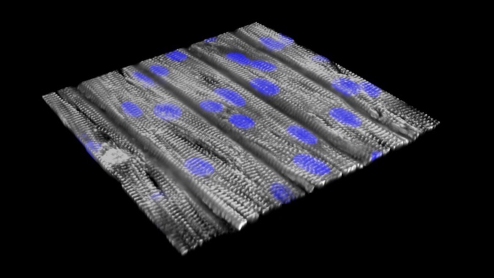 Heat muscle cells.