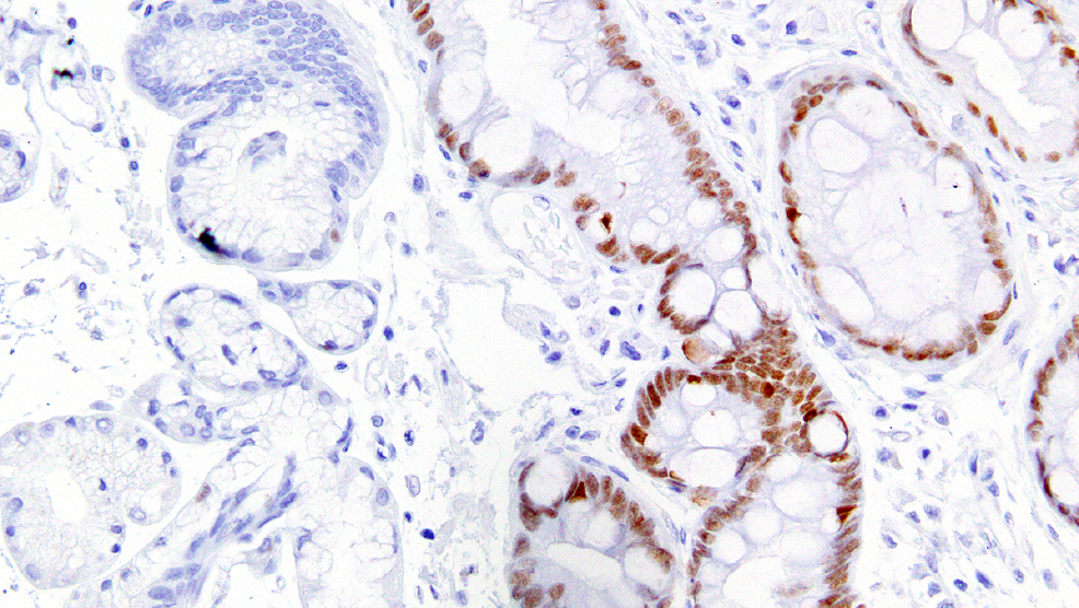 Histology image of the esophagus.