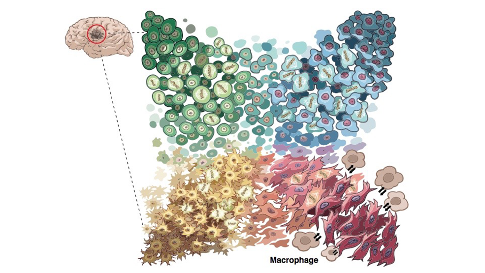 Illustration of four types of tumor cells.