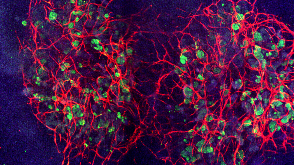 kidney organoids connected by blood vessels