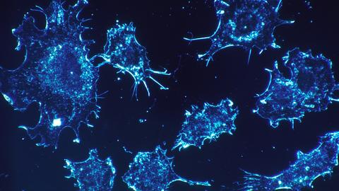 Fluorescent microscopy of blue-stained cancer cells