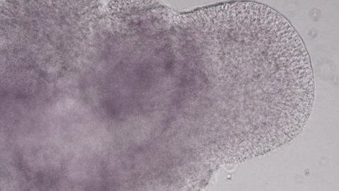 Brain organoids