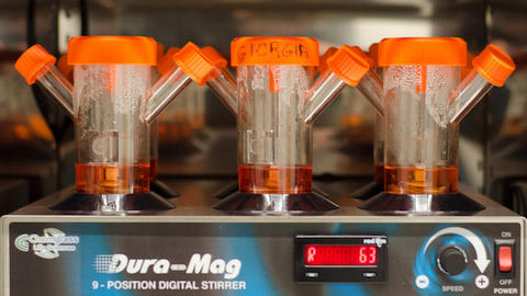 Brain organoids incubating