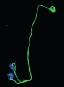 EarNeuronsHearing.jpg