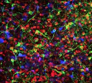 IsacsonNeuron.jpg