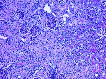 KidneyFibrosisImage.jpg
