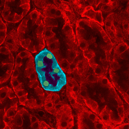 Kidney_tubules.png