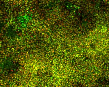 Lam%20article%20pic%20of%20intermediate%20mesoderm%20cells.jpeg