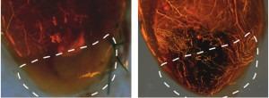 VEGF-A-modRNA-improves-heart-muscle-perfusion-after-MI-300x110.jpg