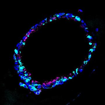image of alveolar epithelial cells