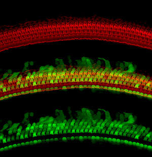 and80 in cochlea