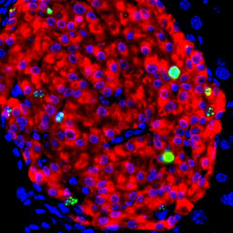 Beta Cells