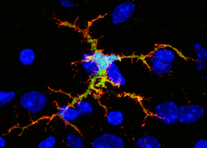 bone marrow-derived cell integrated in brain tissue