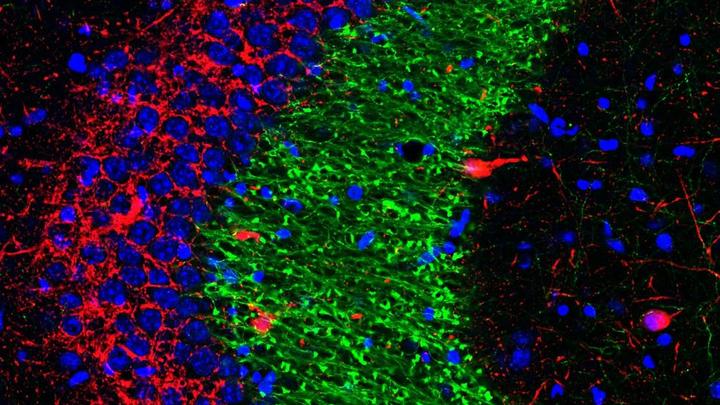 Microscopy image of dentate gyrus cels and hippocampus CA3 interneurons