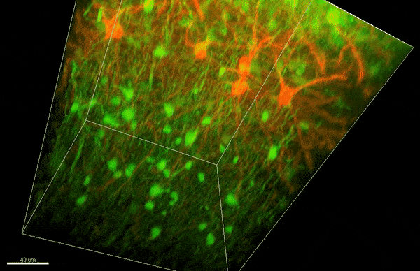 Neurons and their surrounding myelin.