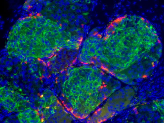 Human beta cells derived from stem cells (Credit: Melton Lab)