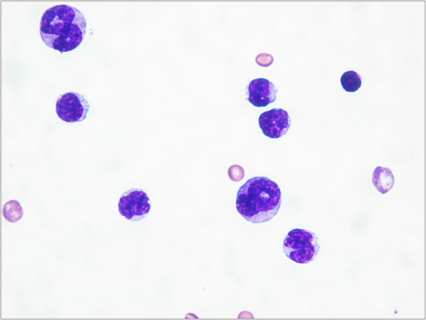 bloodcancercells.png