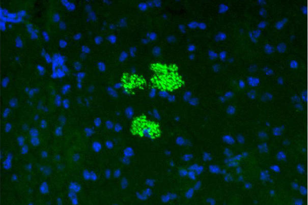 bwh-stemcells.jpg