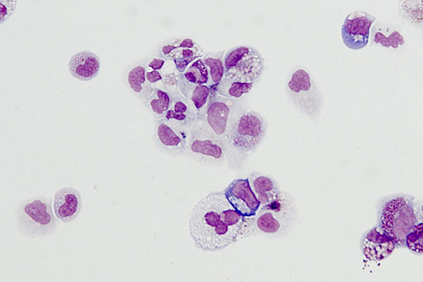 iPSCs