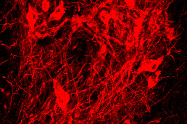 hallett-et-al-csc-image_605.jpg