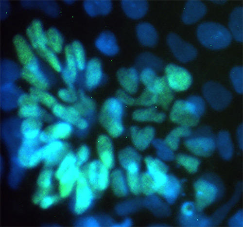 Neural cells made from iPSCs