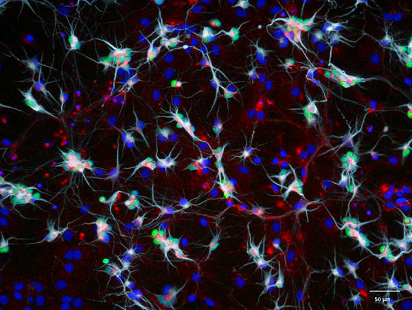 Motor Neurons