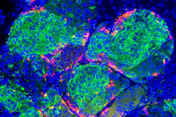human-sc-beta-cells13_605.jpg