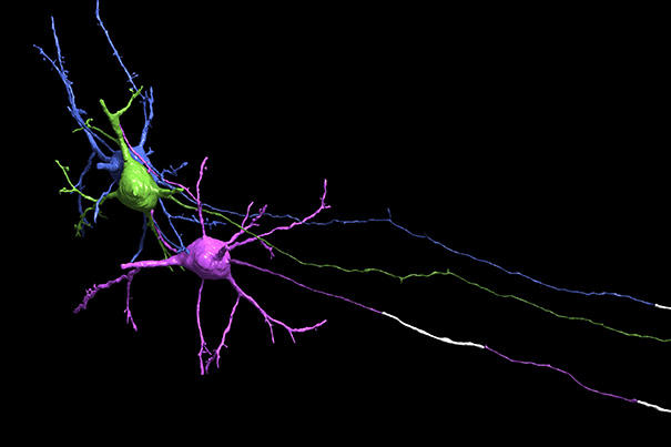 myelin605.jpg