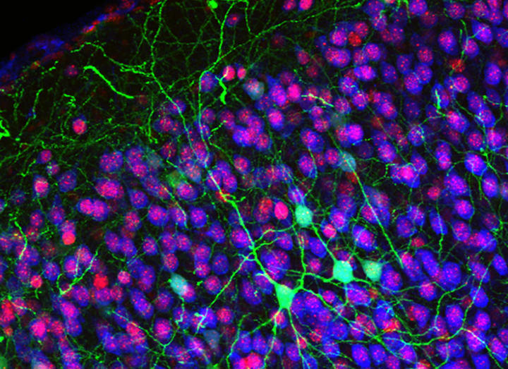 neurons-macklis-sm.jpg