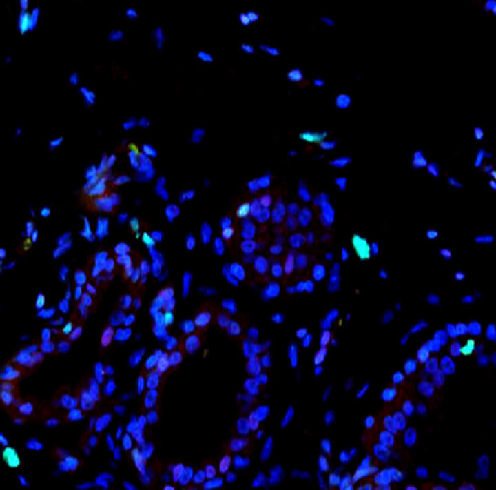 Breast tissue