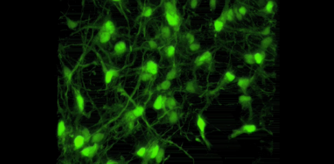 3D cell culture of early-onset Alzheimer's neurons (Credit: Nature)