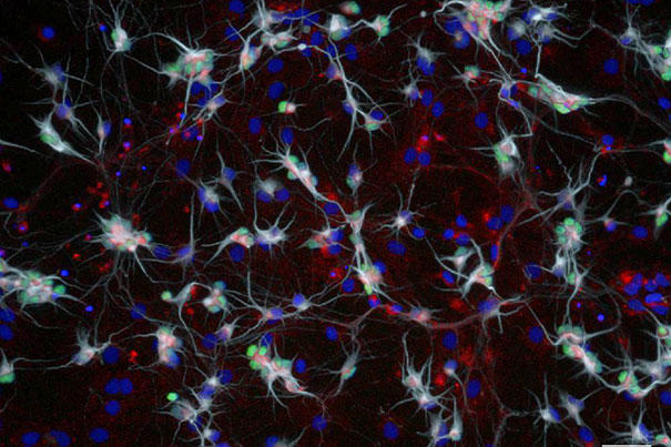 Human motor neurons
